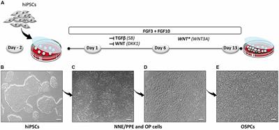 Enriched Differentiation of Human Otic Sensory Progenitor Cells Derived From Induced Pluripotent Stem Cells